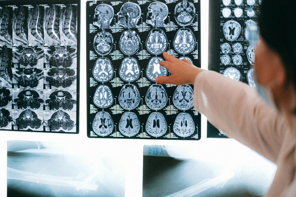neuropsicología de la depresión