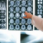 neuropsicología de la depresión