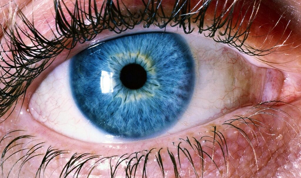Derrame en el ojo por estrés